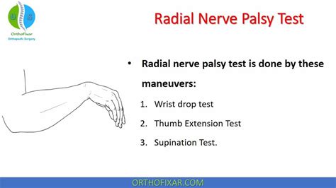 Radial Nerve Palsy Test • Easy Explained Orthofixar 2022