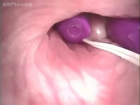 Endoscope Japanese Camera Inside Vagina