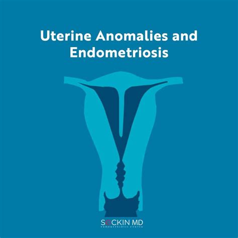 uterine anomalies and endometriosis seckin endometriosis center