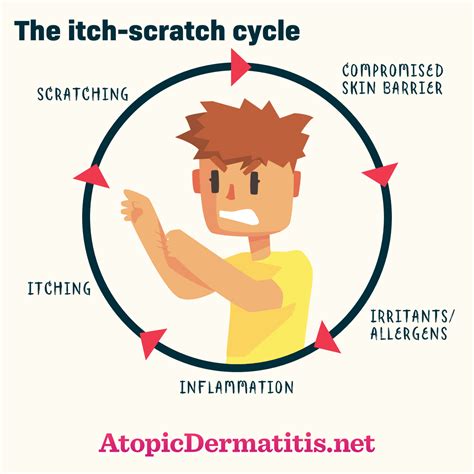 Scratching Itch