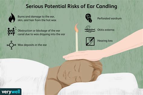 Can Ear Candling Remove Earwax Safely