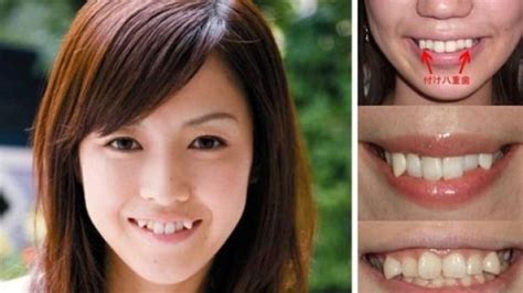 Cute The Snaggletooth Trend Has Been Growing In Japan Japanese Women Crooked Teeth Dentistry
