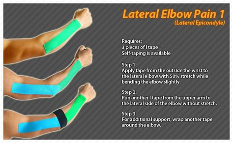 Check spelling or type a new query. Lateral Elbow Pain #Ares #Kinesiology #Tape #Taping | ARES ...
