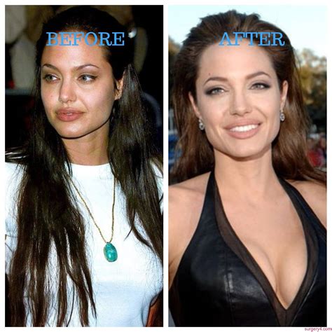 Angelina Jolie Before And After Great Porn Site Without Registration