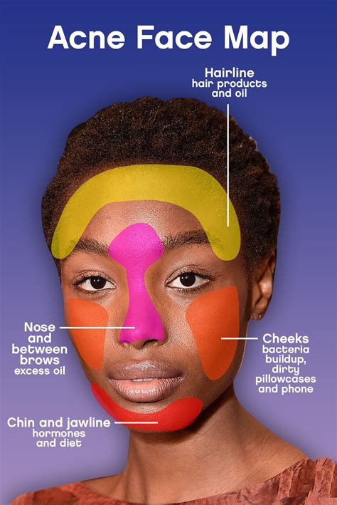 Acne Face Map Heres Why Youre Breaking Out Glamour