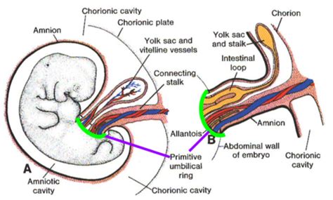 Embryology Umbilical Cord And Amniotic Sac Flashcards Quizlet