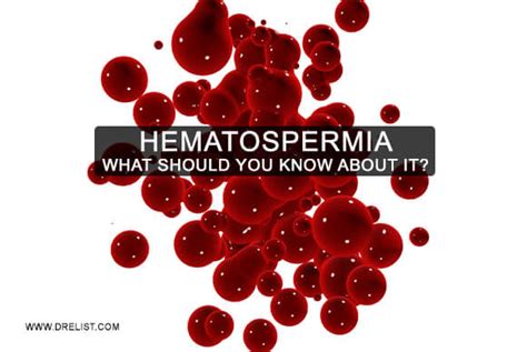 Hematospermia What Should You Know About It Dr Elist S Health Blog