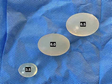 Technical Strategies Implant Sizing In The Side By Side Displacement Testicular Enhancement