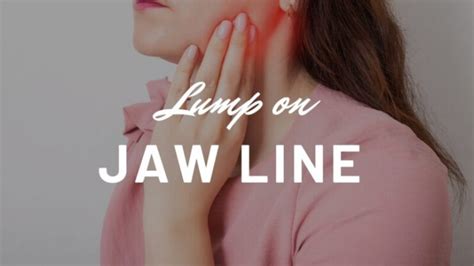 Lump On Jaw Line Hard Movable Painful Near Ear Small Or Large Bump