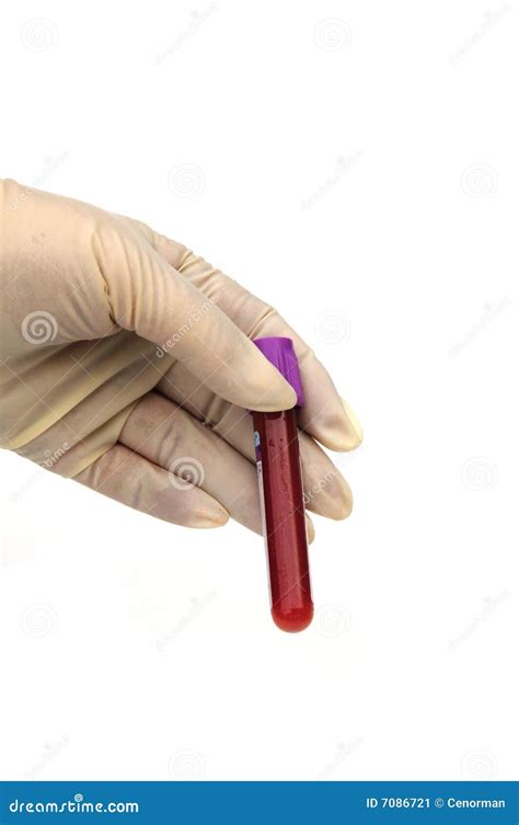 Blood Sample Stock Image Image Of Hands Haemoglobin 7086721