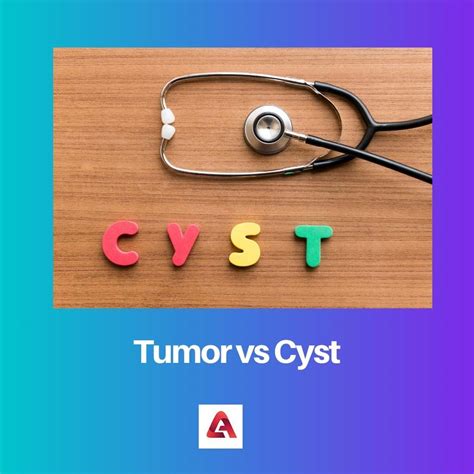 Tumor Vs Cyst Difference And Comparison