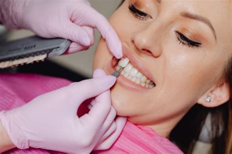 Do You Have To Get Your Teeth Shaved For Veneers Geniusbeauty