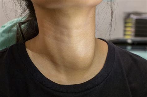 What Bumps On Your Neck Really Mean The Healthy