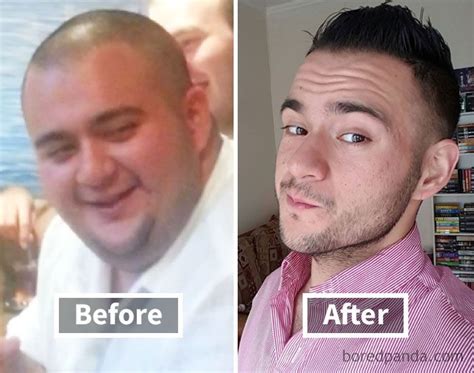 128 Surprising Photos Of Face Fat Loss Before And After Weight Loss Artofit