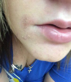 She's vowed to never again use hair removal creamcredit: Nair Hair Remover Lotion. | Beautylish