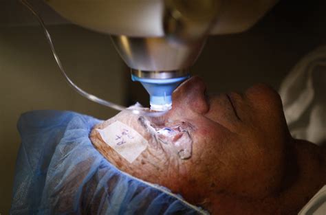 Laser Cataract Surgery Allows For More Precise Less Complicated