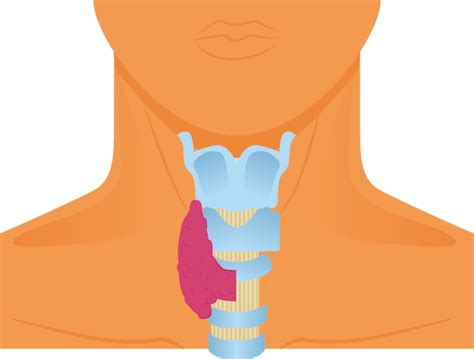 Thyroidectomy Thyroid Surgery Total And Lobectomy Saint Johns