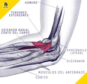 Consumirse Objetor Escribir Una Carta Epicondilitis Anatomia Estribillo