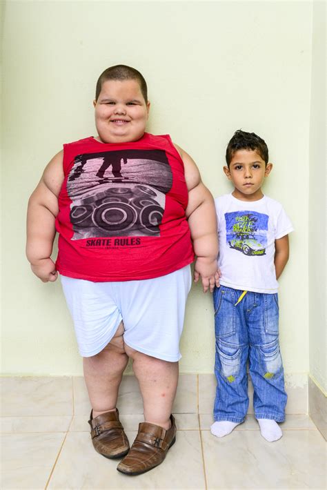 Obese 5 Year Old Misael Caldogno Abreu Risks Suffocating By His Own