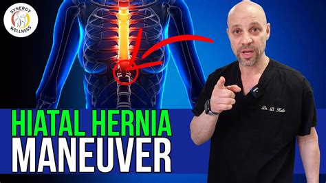 Try Hiatal Hernia Maneuver Before Surgery Youtube