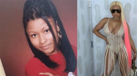 Nicki Minaj Before And After