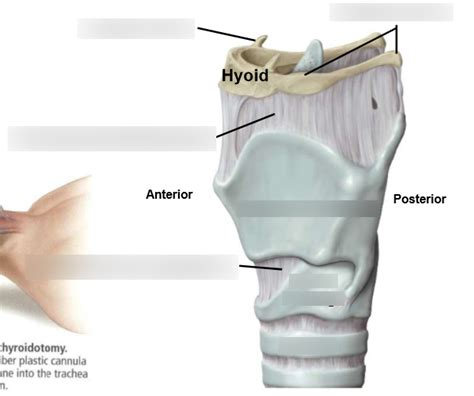 Throat Diagram Quizlet