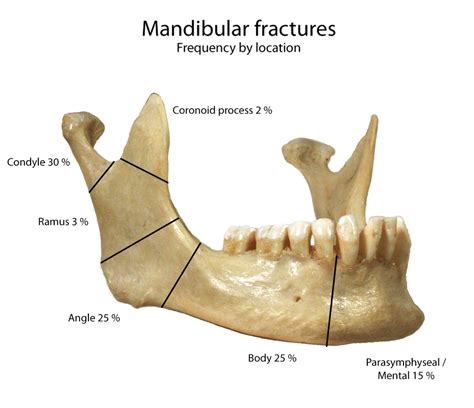 Mandible X Rays Dont Forget The Bubbles