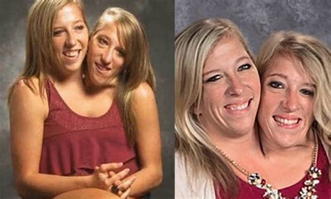 30 Interesting Things About Famous Conjoined Twins Abby And Brittany Hensel Page 7