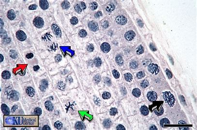We do the lab with the 9th graders. Mitosis in Onion Root Tip Prophase (black) Metaphase ...