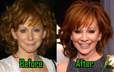 reba mcentire plastic surgery rejuvenates her face boobs before after celebritysurgeryicon