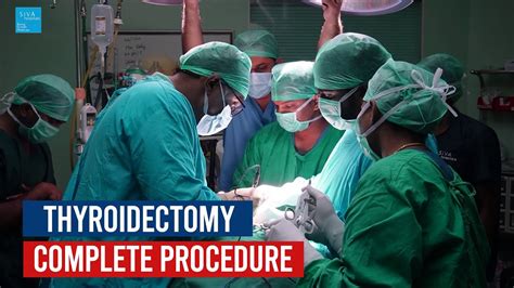 Thyroidectomy Step By Step Operative Surgery Youtube