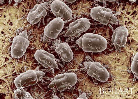 Mites Human Skin Parasites And Delusional Parasitosis