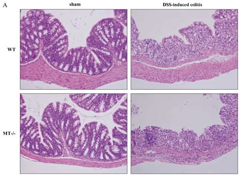 Colon Vs Small Intestine Histology Thoc1 Gene Deletion Affects The Histology Of The Small