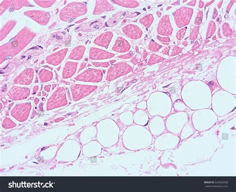 Стоковая фотография 624566558 Histology Human Tissue Show Skeletal