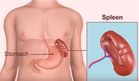 Spleen Pain Location Pictures Causes Symptoms Treatment Med Mum