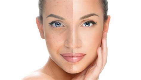 What Is Skin Pigmentation Secrets In Beauty