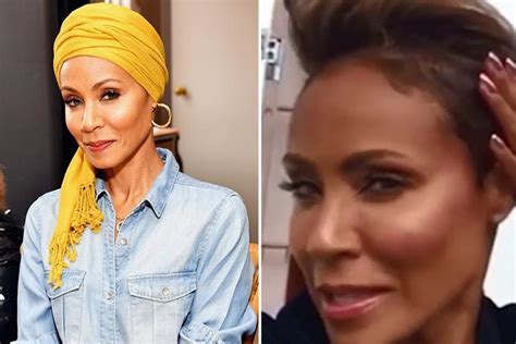 Jada Pinkett Smith Reveals Shes Having Steroid Injections To Battle