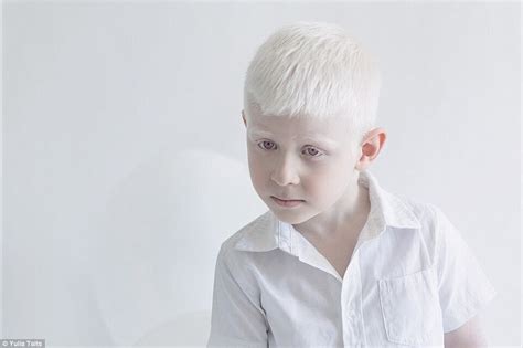Stunning Fairy Tale Albinos Portraits By Yulia Taits