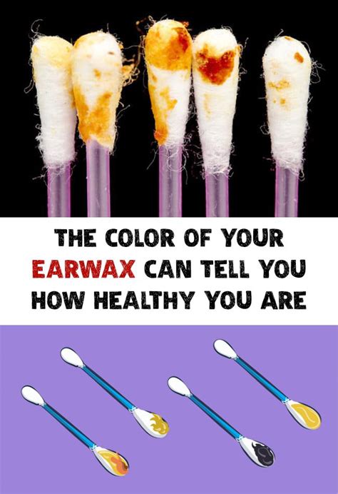 The Color Of Your Earwax Can Tell You How Healthy You Are Ear Wax