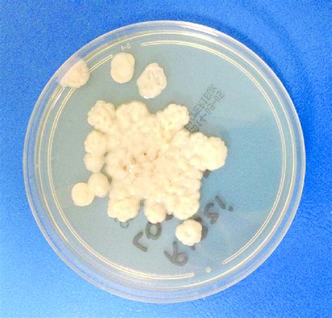 White Creamy And Smooth Colonies Of Trichosporon Mucoides Download