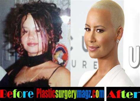 Amber Rose Plastic Surgery Before And After Pictures Plastic Surgery Magazine