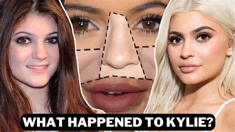 The Tragic Transformation Of Kylie Jenner This Is So Strange Youtube