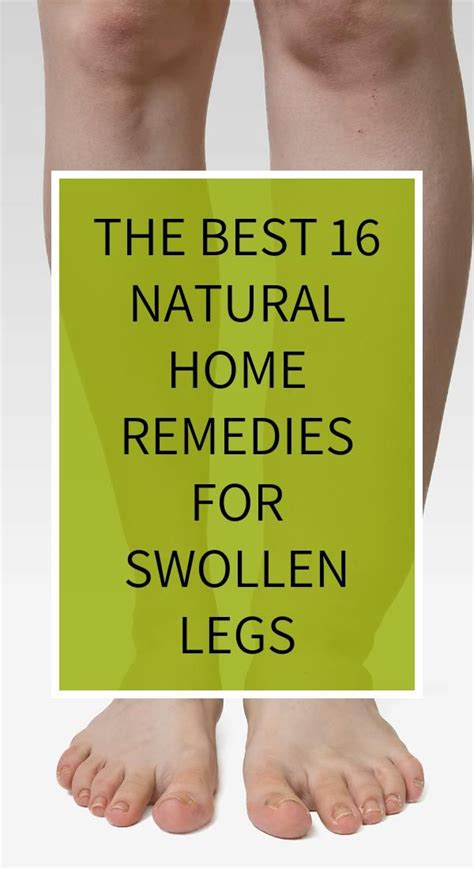 The Best 16 Natural Home Remedies For Swollen Legs Natural Home Remedies Home Remedies