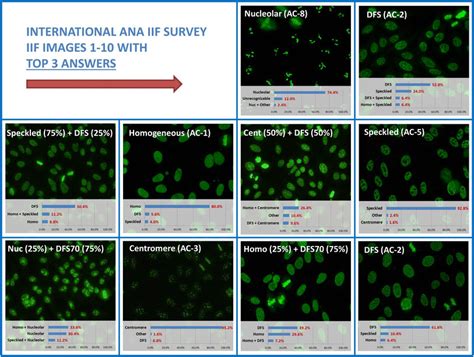 Results Of The Ten Indirect Immunofluorescence Iif Images Used In The