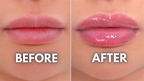 How To Get Soft Plump Juicy Lips In Easy Steps Korean Lip Care