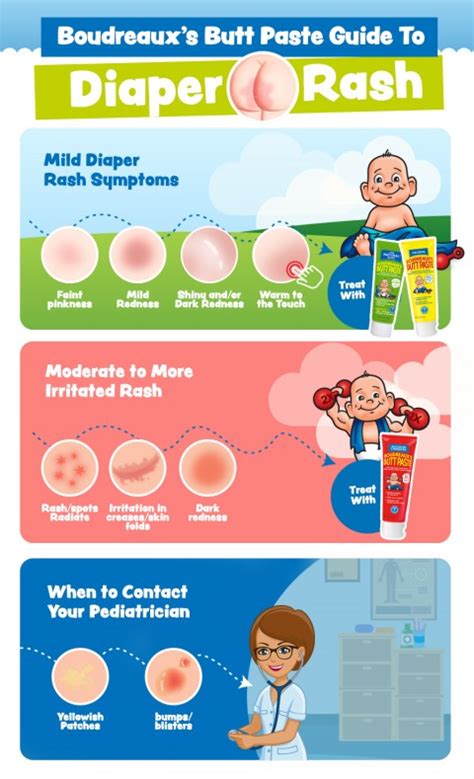 Boudreauxs Butt Paste Guide To Diaper Rash