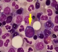 Cara menaikkan trombosit yang mudah adalah dengan mengonsumsi makanan kaya akan nutrisi dan vitamin. Trombosit (sel darah pembeku atau keping darah ...
