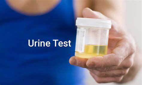 Interpretation Of Urine Sediment Test Varies Significantly Among Kidney