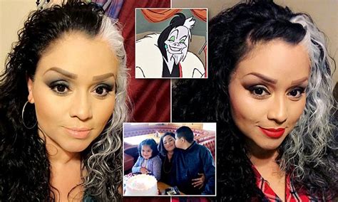 Mom Says She Is Called Cruella De Vil Every Day Due To White Streak In Her Hair Caused By