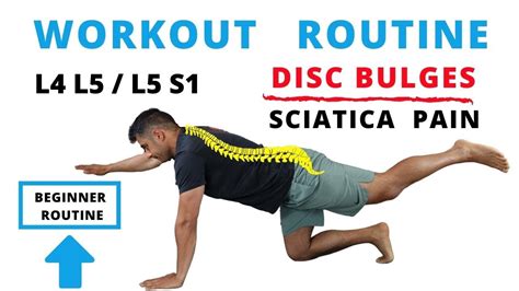 Workout Routine For L4 L5 L5 S1 Disc Bulges And Sciatica Pain